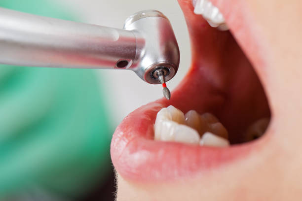 Best Emergency Treatment for Toothache in Fall Creek, WI